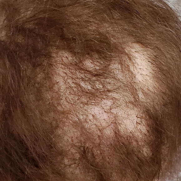 🔴🔴 SOLD 🔴🔴 - Picture 5 of 16